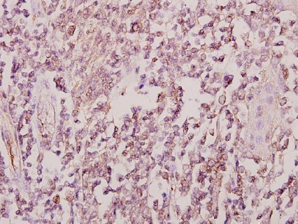 Immunohistochemistry (IHC) analyzes of ZIS (I144) pAb in paraffin-embedded human tonsil carcinoma tissue at 1:50