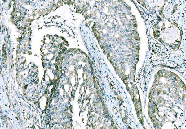  IHC analysis of CD101 using anti-CD101 antibody (A07106-1)