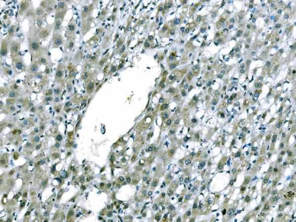  IHC analysis of CD101 using anti-CD101 antibody (A07106-1)