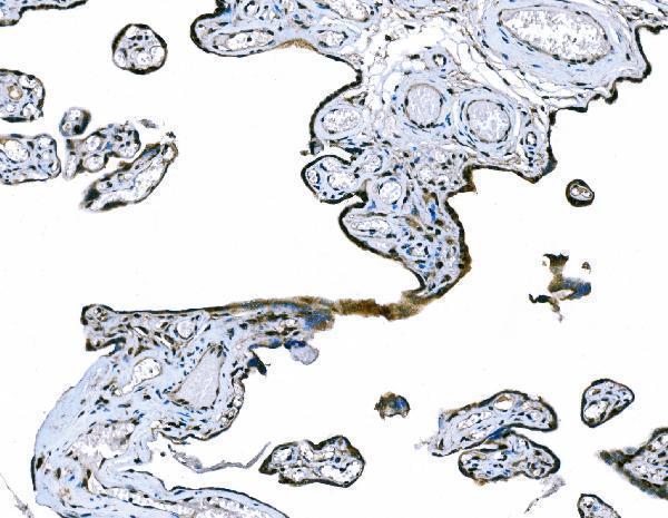 a07106 1 cd101 primary antibodies ihc testing 4