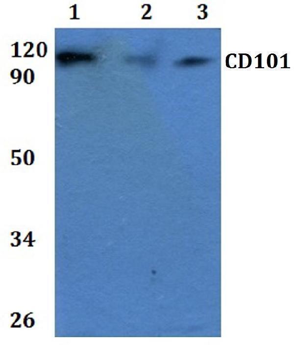 Western blot (WB) analysis of CD101 polyclonal antibody at 1:500 dilution  Lane1:HEK293T whole cell lysate
Lane2:RAW264