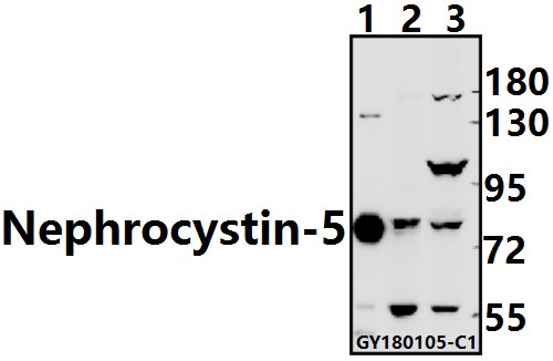 Western blot (WB) analysis of Nephrocystin-5 (R467) pAb at 1:1000 dilution
Lane1:The Kidney tissue lysate of Mouse(5ug)
Lane2:The Ovary tissue lysate of Rat(40ug)
Lane3:HCT116 whole cell lysate(40ug)