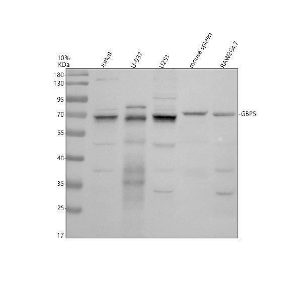 Western blot analysis of GBP5 using anti-GBP5 antibody (A07110-1)