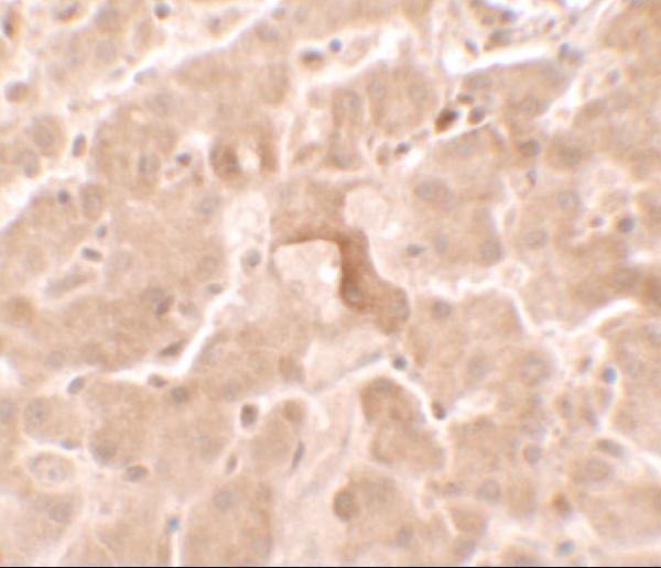 a07110 gbp5 primary antibodies ihc testing 2