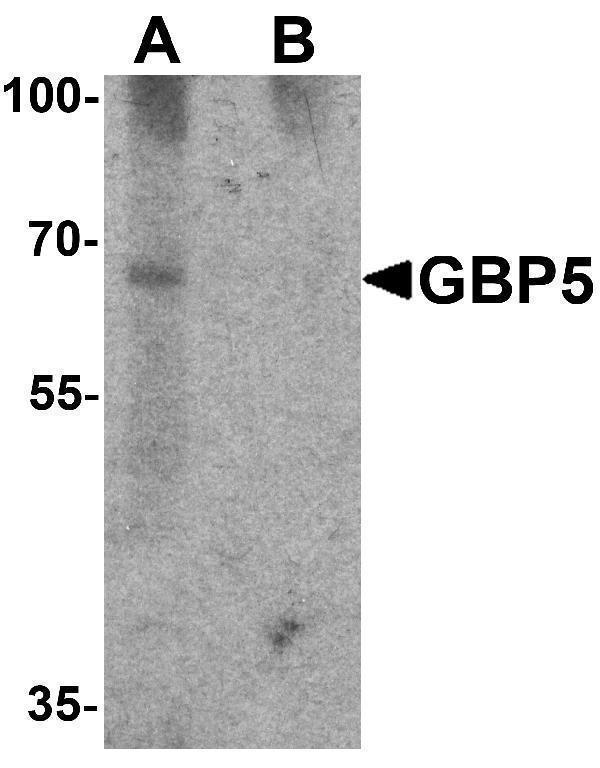 a07110 gbp5 primary antibodies wb testing 1