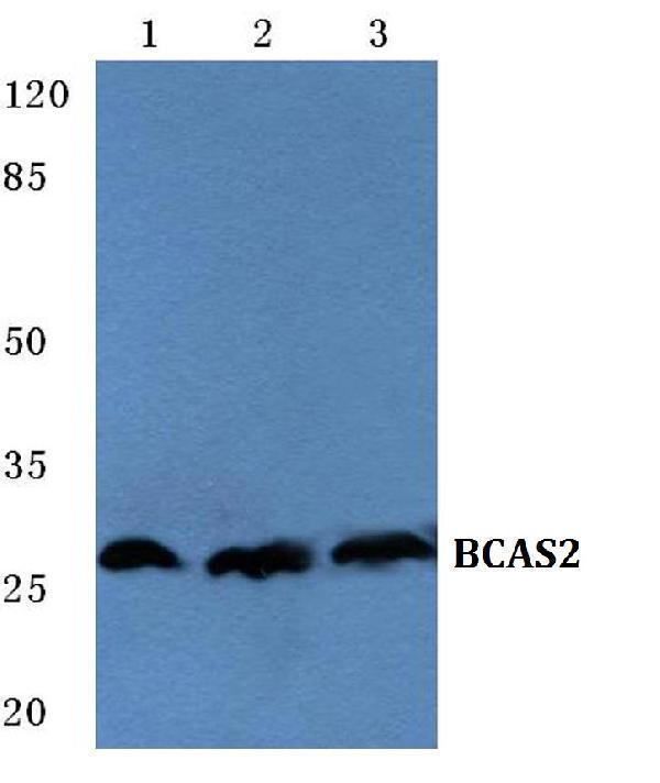 Western blot (WB) analysis of BCAS2 polyclonal antibody at 1:500 dilution
Lane1:HEK293T cell lysate
Lane2:Mouse heart tissue lysate
Lane3:PC12 cell lysate