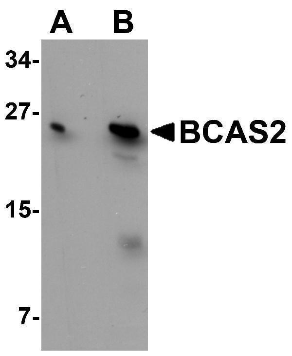 a07113 bcas2 primary antibodies wb testing 1