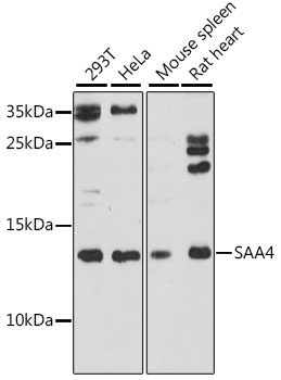Western blot analysis of extracts of various cell lines, using SAA4 antibody