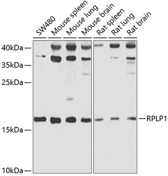 a07117 rplp1 primary antiboties wb testing 1