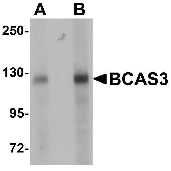 Western blot analysis of BCAS3 in rat brain tissue lysate with BCAS3 antibody at (A) 0