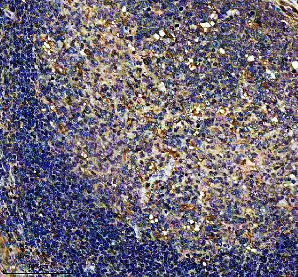 IHC analysis of EFHD2 using anti-EFHD2 antibody (A07124-2)