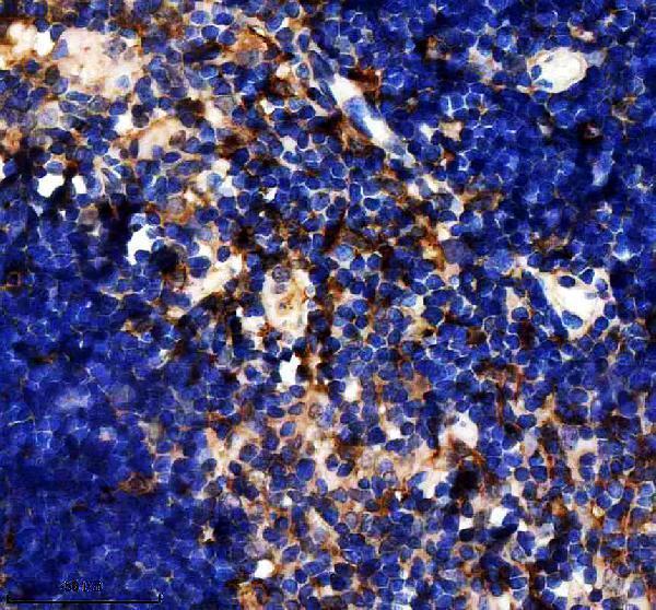 IHC analysis of EFHD2 using anti-EFHD2 antibody (A07124-2)