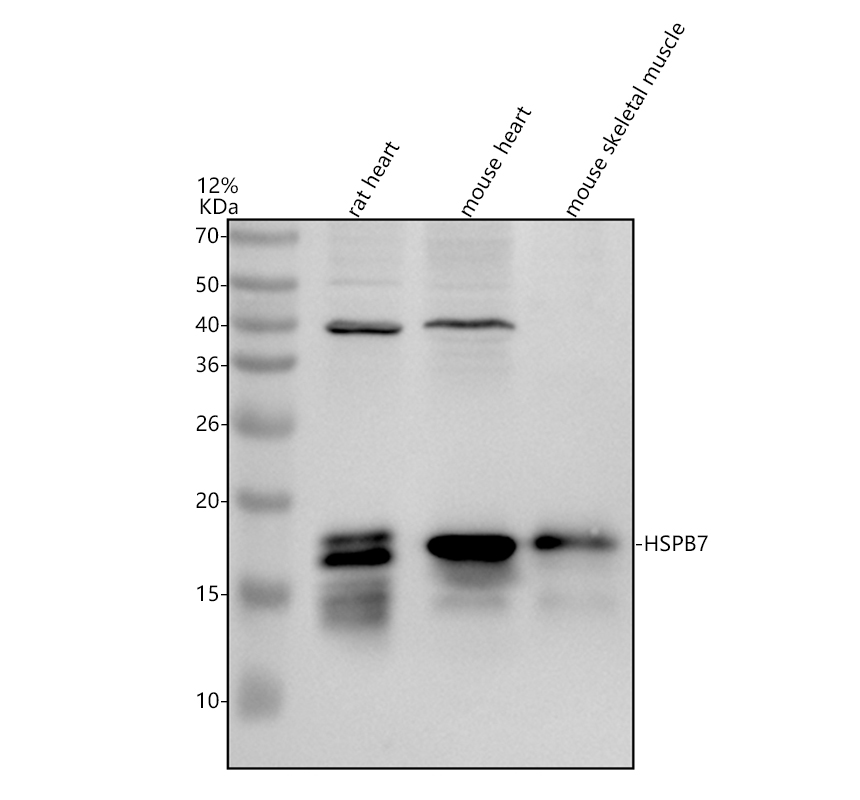 a07126 2 hspb7 primary antibodies wb testing 1