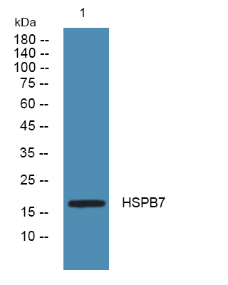 Western blot analysis of lysates from DU145 cells, primary antibody was diluted at 1:1000, 4°over night