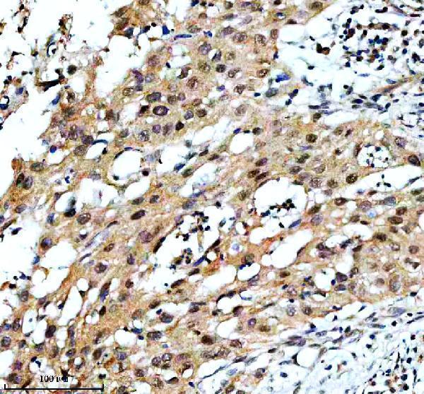 IHC analysis of TAF3 using anti-TAF3 antibody (A07129-1)