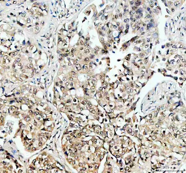 IHC analysis of TAF3 using anti-TAF3 antibody (A07129-1)