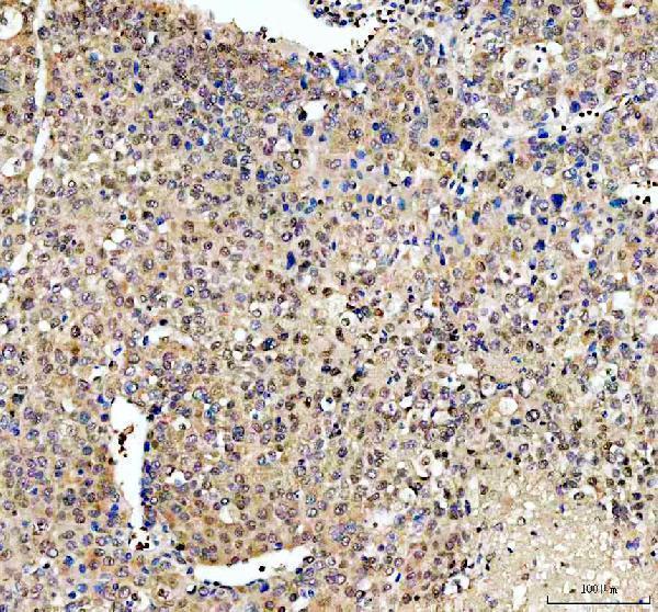 a07129 1 taf3 primary antibodies ihc testing 3