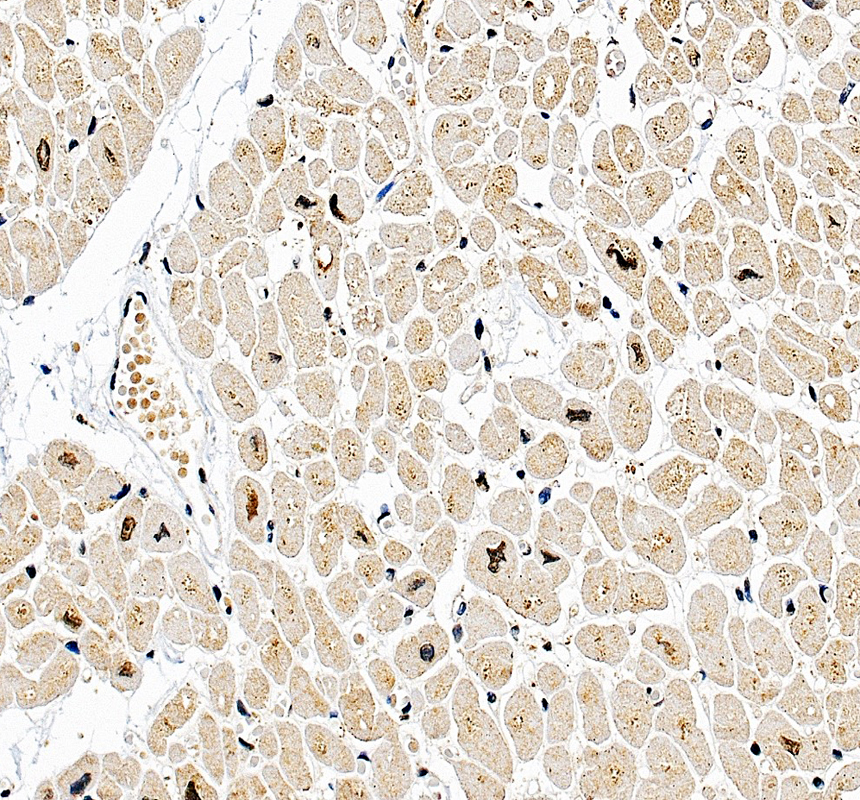 IHC analysis of RBPMS using anti-RBPMS antibody (A07130-2)