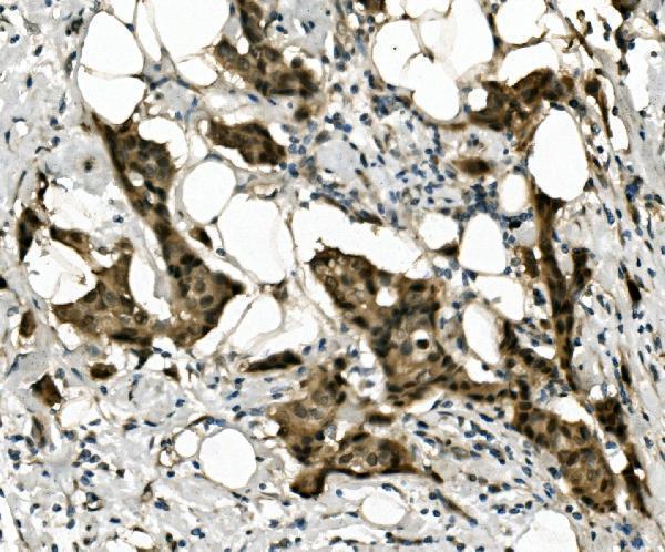  IHC analysis of RBPMS using anti-RBPMS antibody (A07130-2)