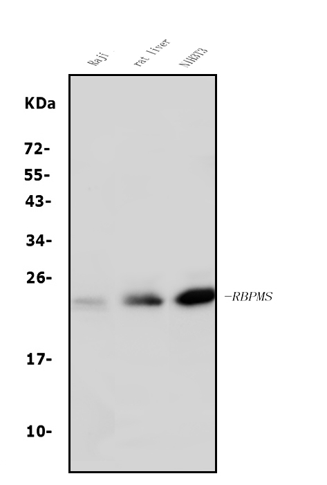  Western blot analysis of RBPMS using anti-RBPMS antibody (A07130-2)
