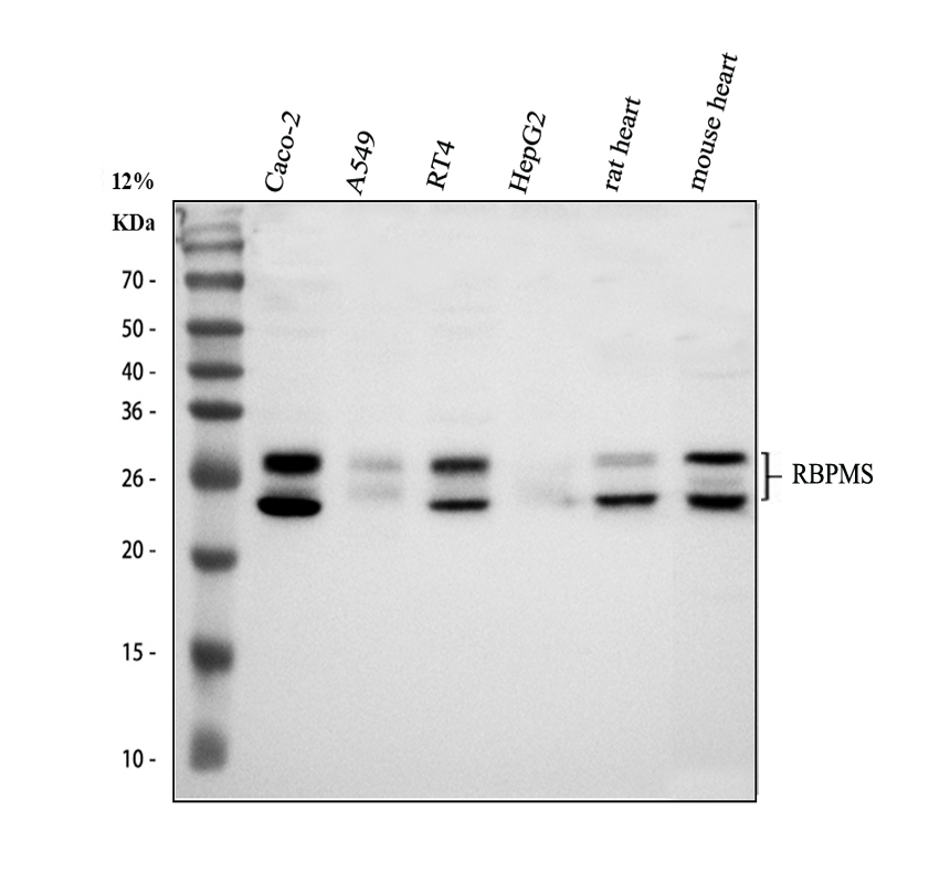 Western blot analysis of RBPMS using anti-RBPMS antibody (A07130-2)