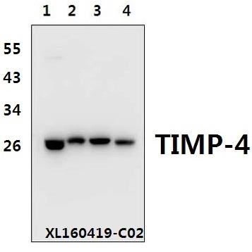 Western blot (WB) analysis of TIMP-4 (S206) polyclonal antibody at 1:500 dilution
Lane1:HEK293T whole cell lysate(40ug)
Lane2:H9C2 whole cell lysate(40ug)
Lane3:The Heart tissue lysate of Rat(40ug)
Lane4:The Heart tissue lysate of Mouse(40ug)