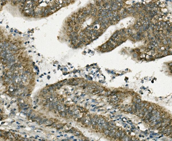 a07132 fabp6 primary antibodies ihc testing 2