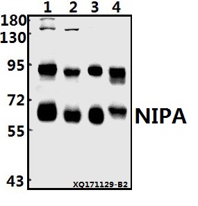 Western blot (WB) analysis of NIPA (S350) pAb at 1:500 dilution
Lane1:PC3 whole cell lysate(20ug)
Lane2:K562 whole cell lysate(40ug)
Lane3:HEK293T whole cell lysate(10ug)
Lane4:AML-12 whole cell lysate(40ug)