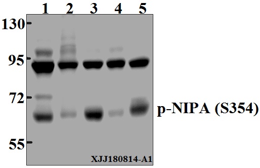 Western blot (WB) analysis of p-NIPA (S354) pAb at 1:500 dilution
Lane1:Hela whole cell lysate(40µg)
Lane2:SK-OVCAR3 whole cell lysate(40µg)
Lane3:MCF-7 whole cell lysate(40µg)
Lane4:C6 whole cell lysate(40µg)
Lane5:CT-26 whole cell lysate(40µg)