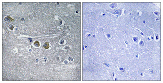 Immunohistochemistry validation of RPL15 using Anti-Ribosomal Protein L15 RPL15 Antibody (A07136-1)