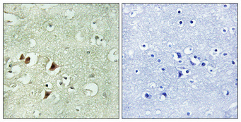 Immunohistochemistry validation of RPL15 using Anti-Ribosomal Protein L15 RPL15 Antibody (A07136-1)