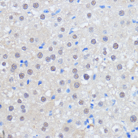 Immunohistochemistry of paraffin-embedded rat liver using RBM39 antibody  at dilution of 1:100 