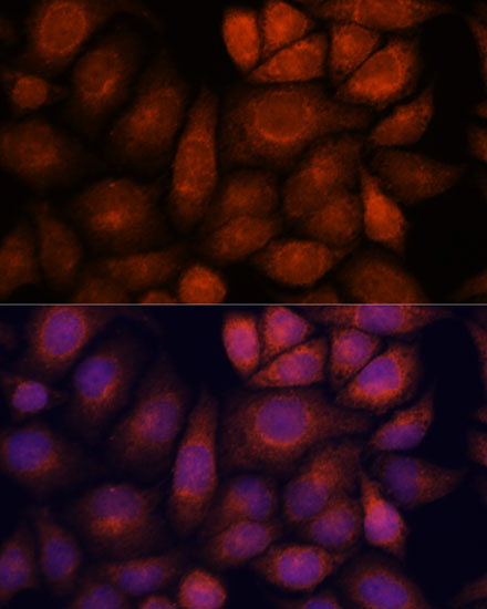 a07139 kif13a primary antiboties if testing 2