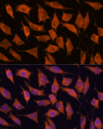 a07139 kif13a primary antiboties if testing 3