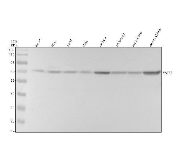 Western blot analysis of FATP2/SLC27A2 using anti-FATP2/SLC27A2 antibody (A07140-1)
