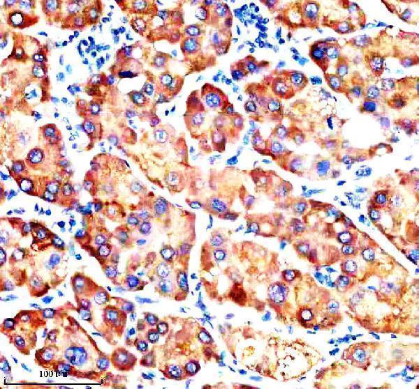 IHC analysis of FATP2/SLC27A2 using anti-FATP2/SLC27A2 antibody (A07140-1)