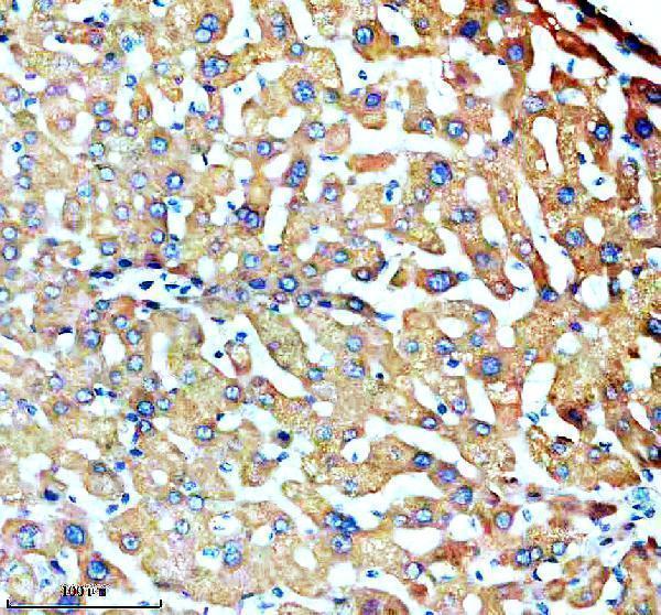 a07140 1 slc27a2 primary antibodies ihc testing 2