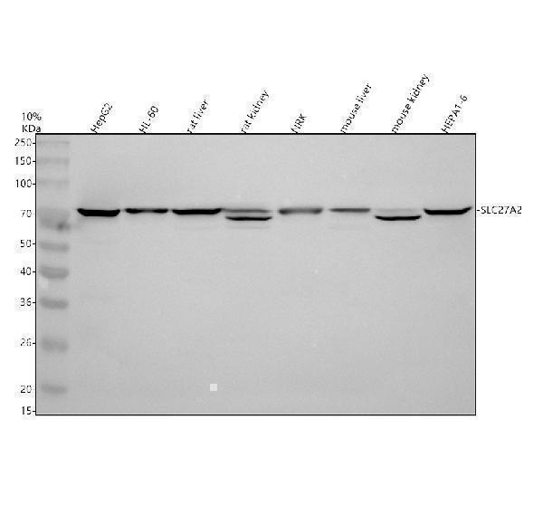 Western blot analysis of FATP2/SLC27A2 using anti-FATP2/SLC27A2 antibody (A07140-1)