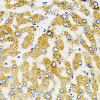 Immunohistochemistry of paraffin-embedded human liver using SLC27A2 antibody  at dilution of 1:100 