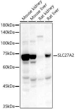 Western blot analysis of extracts of various cell lines, using SLC27A2 antibody  at  1:567 dilution