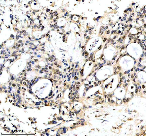 a07144 1 gcat primary antibodies ihc testing 1