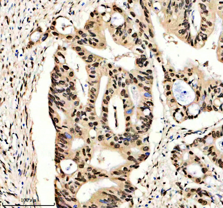 IHC analysis of HNRNPAB using anti-HNRNPAB antibody (A07146-2)