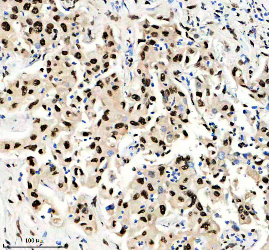 IHC analysis of HNRNPAB using anti-HNRNPAB antibody (A07146-2)