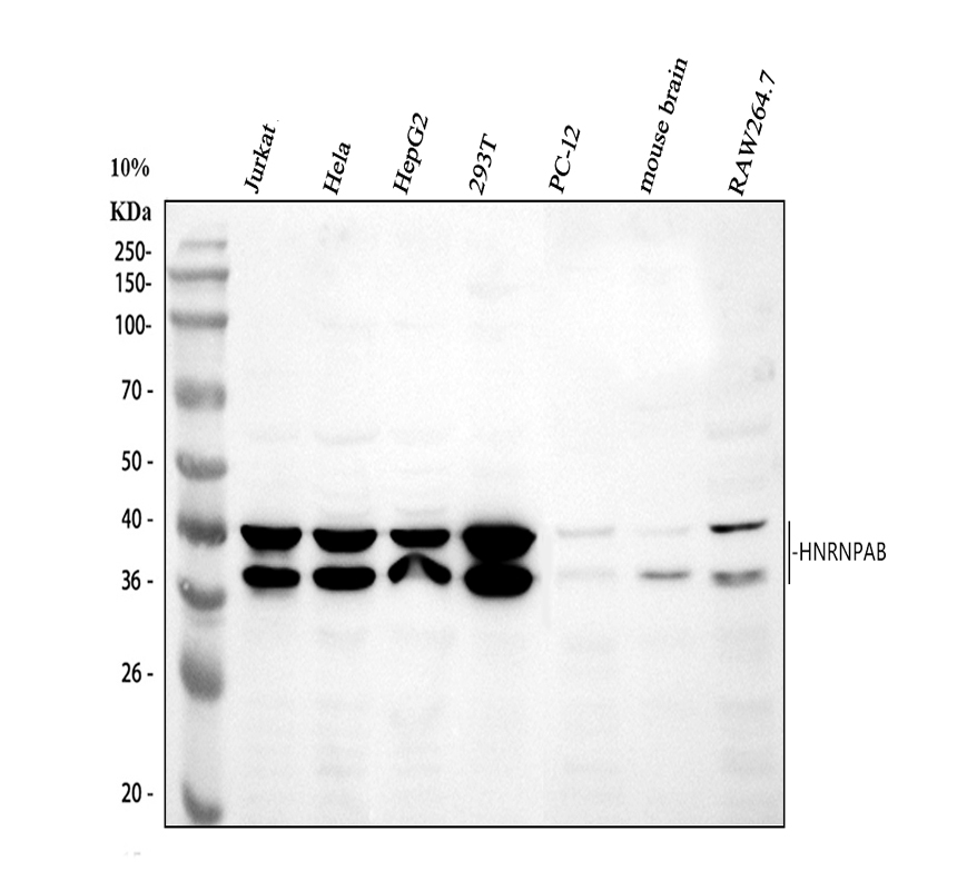 Western blot analysis of HNRNPAB using anti-HNRNPAB antibody (A07146-2)