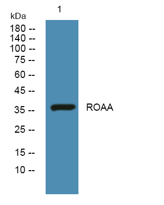 Western blot analysis of lysates from U2OS cells, primary antibody was diluted at 1:1000, 4°over night