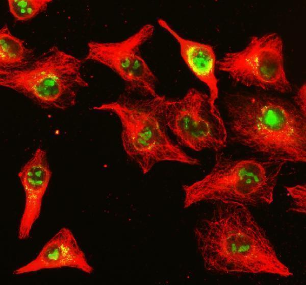 a07147 1 nup85 primary antibodies if testing 1