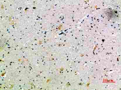 Immunohistochemical analysis of paraffin-embedded human-brain, antibody was diluted at 1:200