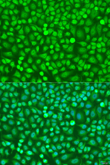 a07156 1 hoxb5 primary antiboties if testing 3
