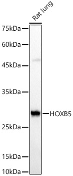 a07156 1 hoxb5 primary antiboties wb testing 1