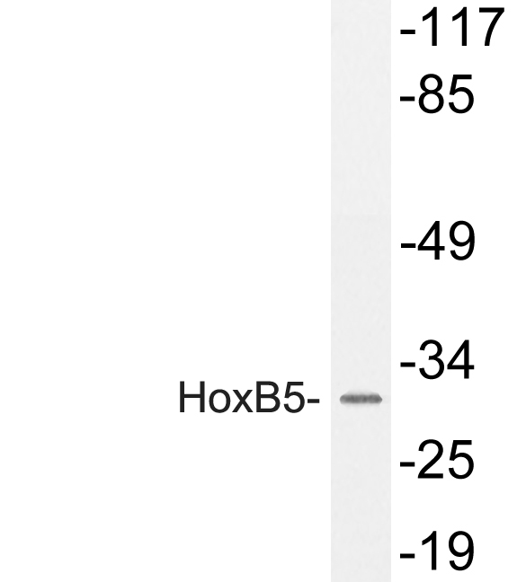 a07156 hoxb5 primary antibodies wb testing 1